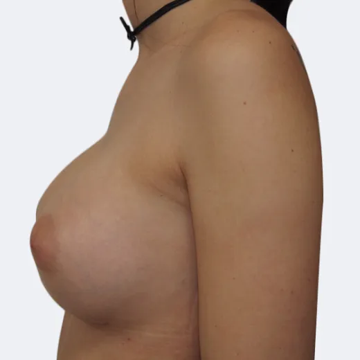 Image after