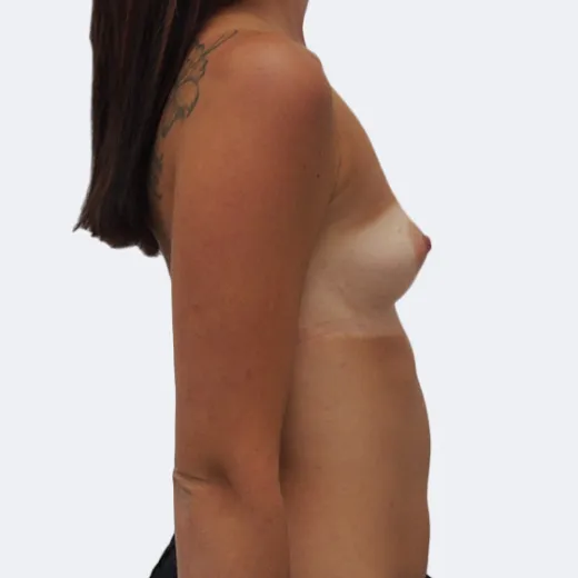 Image before