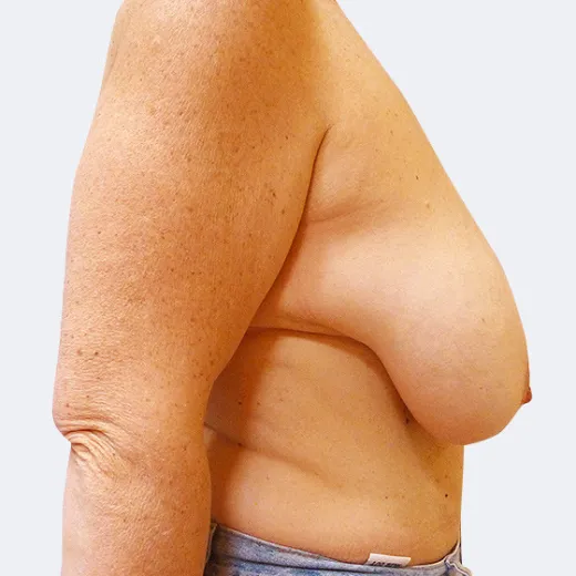 Image before