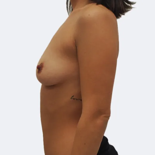 Image before