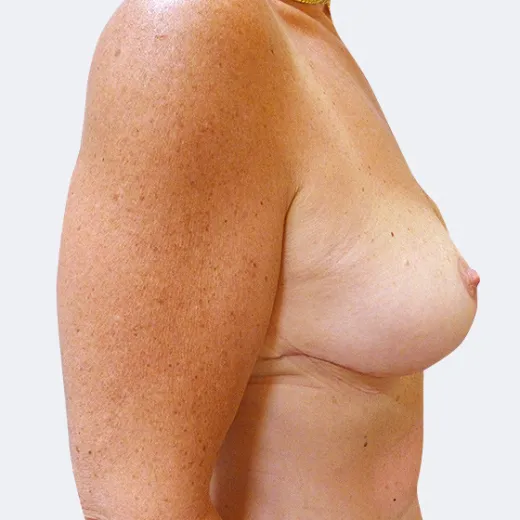 Image after