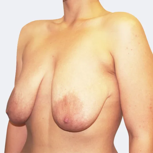 Image before