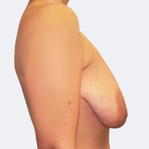 Image before