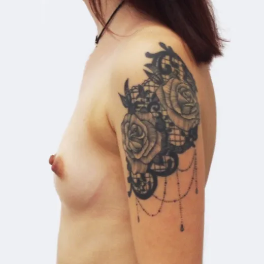 Image before