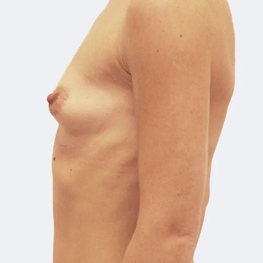 Image before