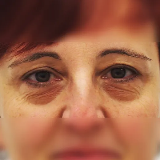 Image before