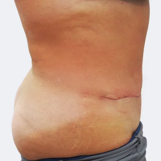Image after
