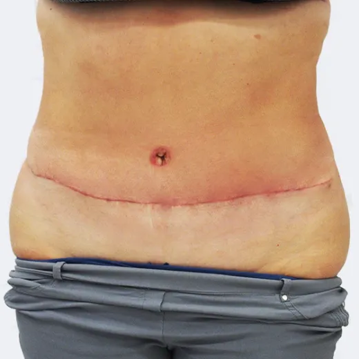 Image after