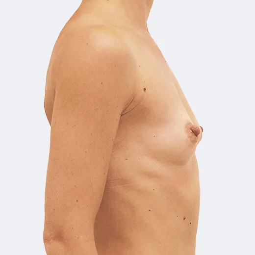 Image before