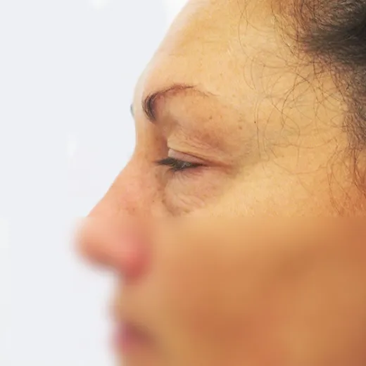 Image before