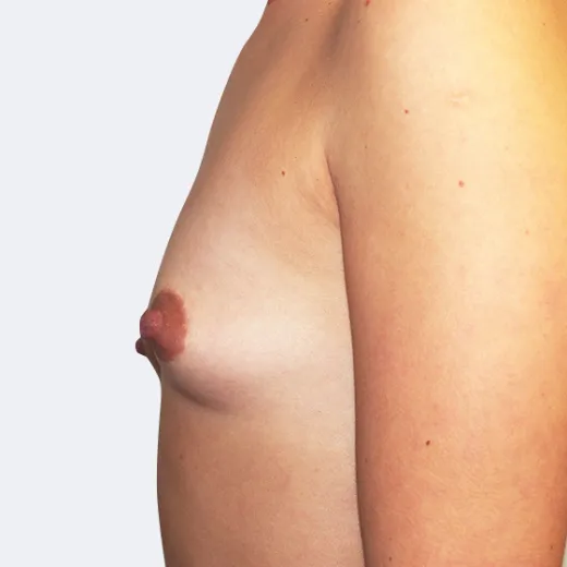 Image before