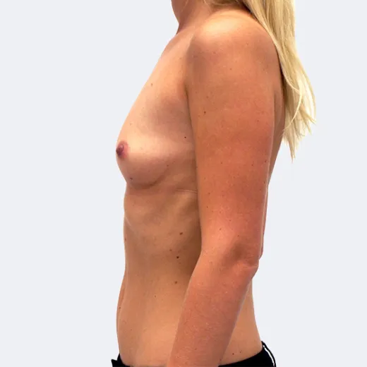 Image before