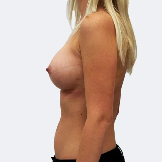 Image after