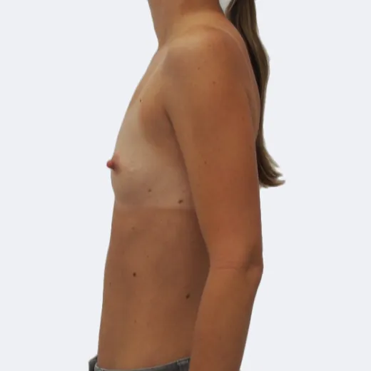 Image before