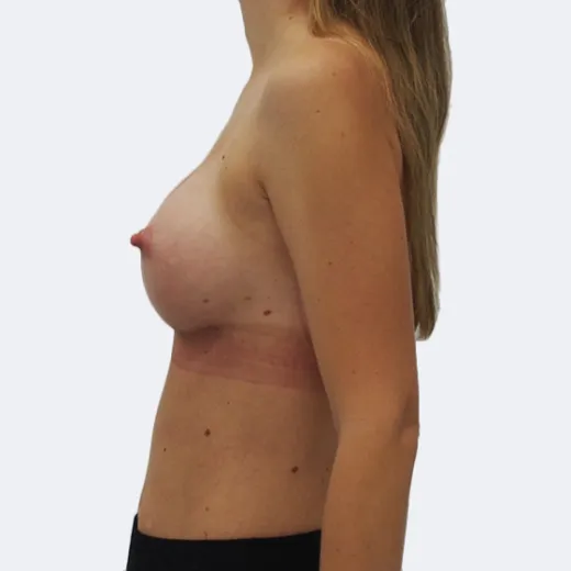 Image after