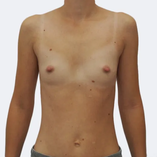 Image before