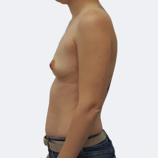 Image before