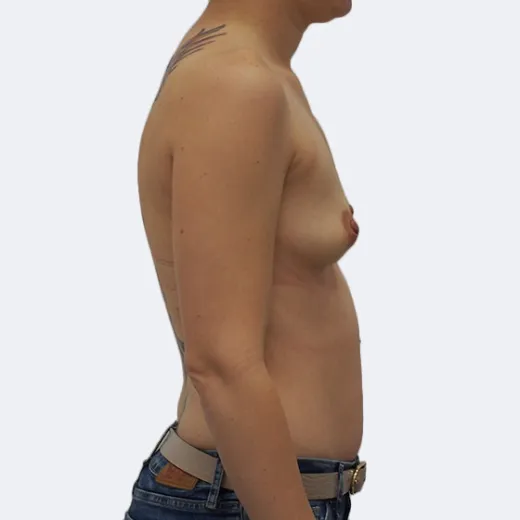 Image before