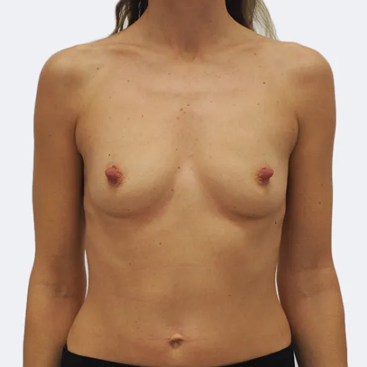 Image before