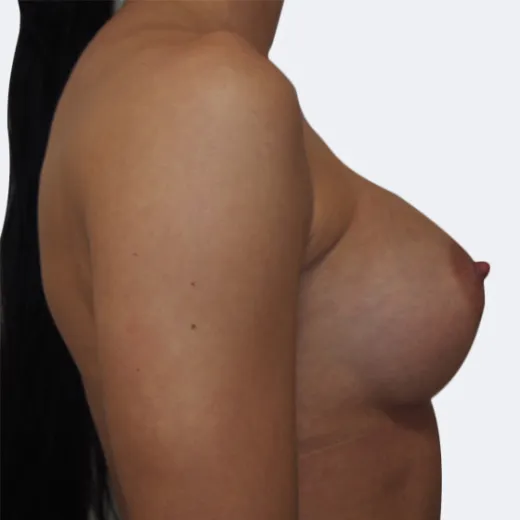 Image after