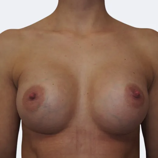 Image after