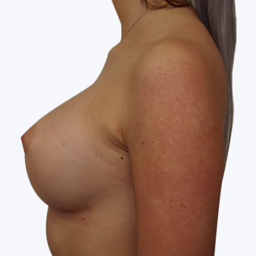 Image after