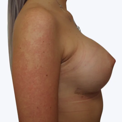 Image after