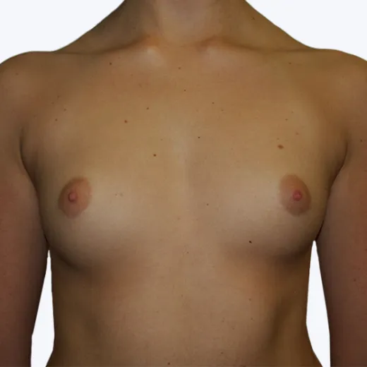 Image before