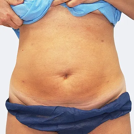 Image after