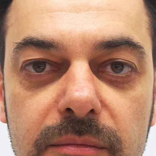 Image after