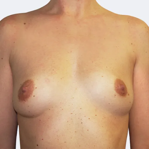 Image before