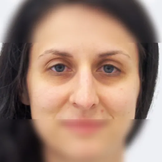 Image before