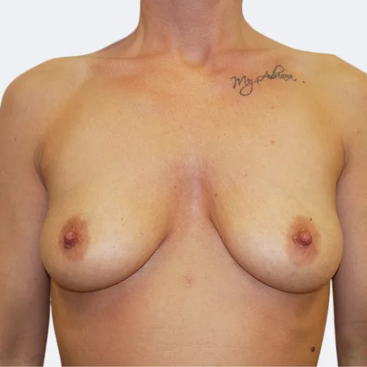 Image before