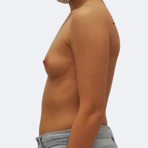 Image before