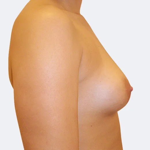 Image before