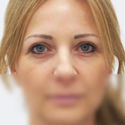 Image after