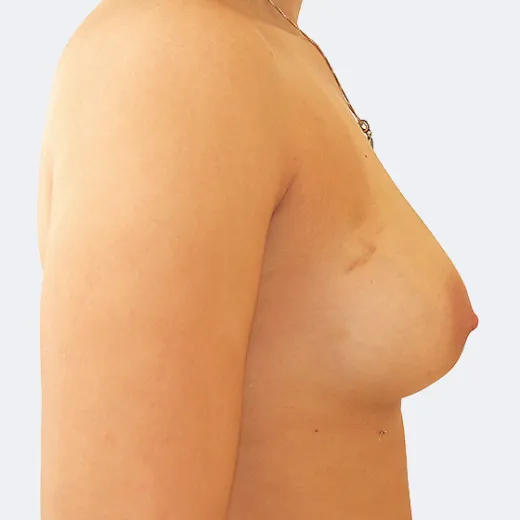 Image after