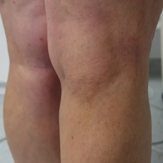 Image after
