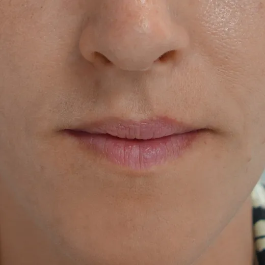 Image before