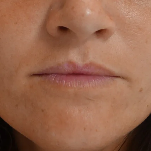 Image before
