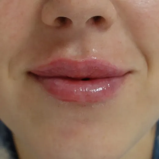 Image after