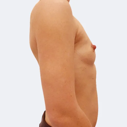 Image before