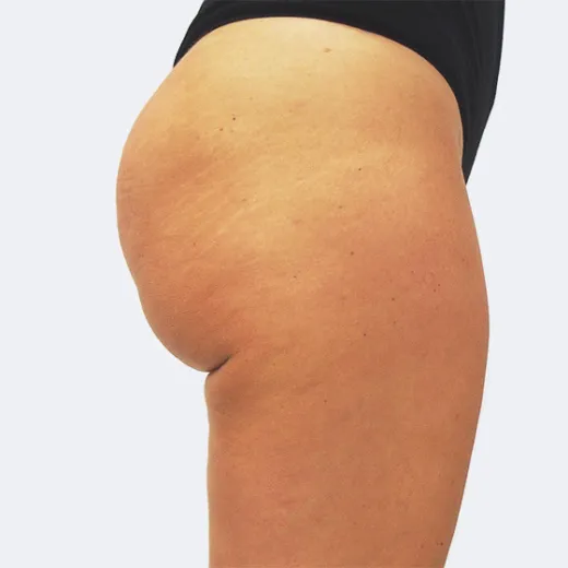 Image after