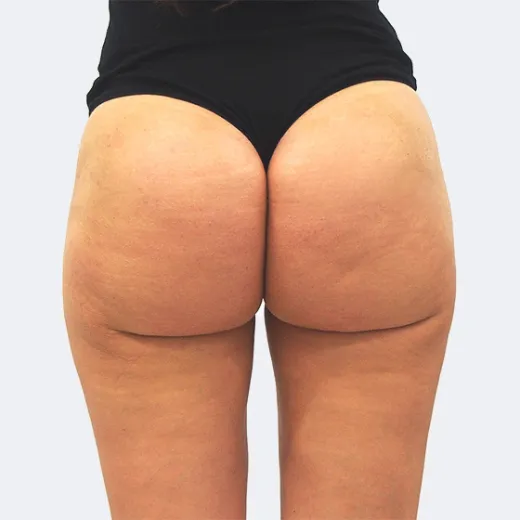 Image after