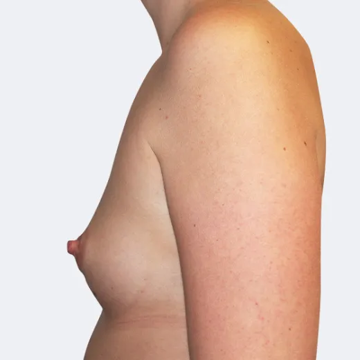 Image before