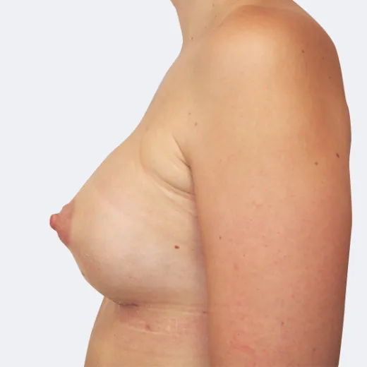 Image after
