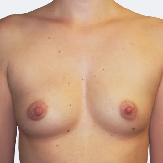 Image before