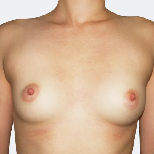Image before