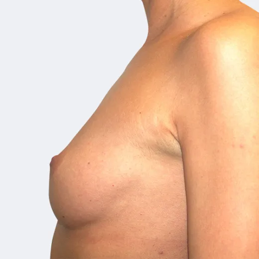 Image before