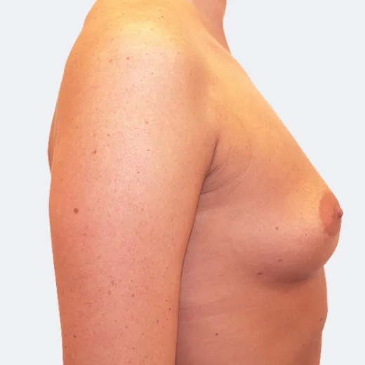 Image before